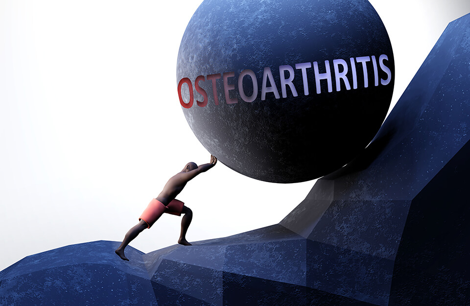 Osteoartrit